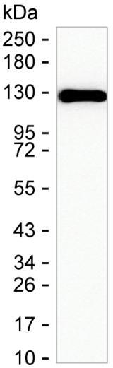 PPP1R9B